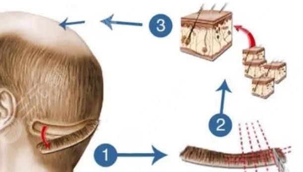 北京大學(xué)深圳醫(yī)院擅長(zhǎng)項(xiàng)目科普