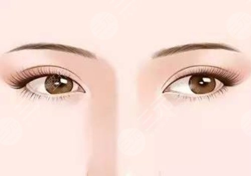 曹仁昌修復(fù)眼睛真的厲害嗎？