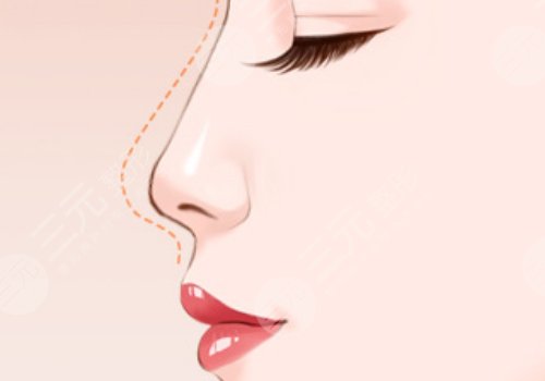 翹鼻和直鼻哪個(gè)好看？