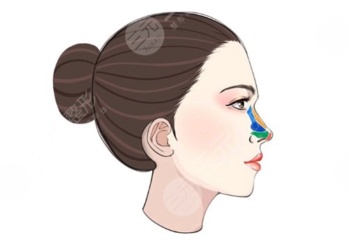 翹鼻和直鼻哪個(gè)好看