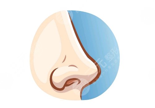 徐翔醫(yī)生做鼻子怎么樣 