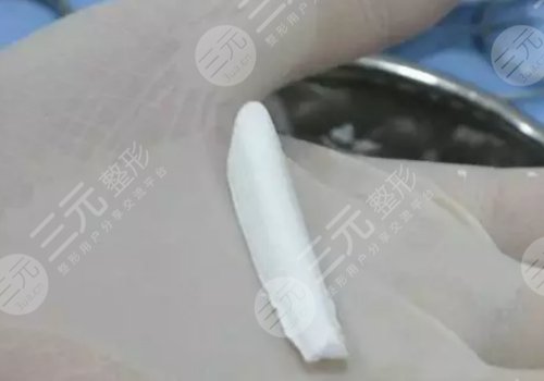 美植挺膨體是國產(chǎn)還是進口
