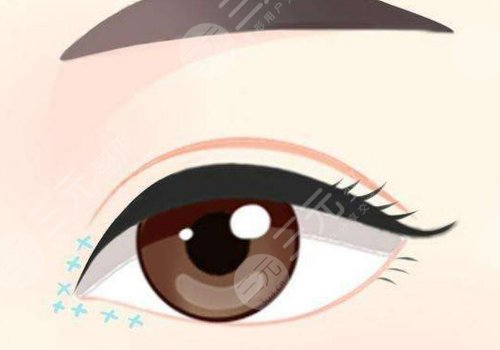 浙江省立同德醫(yī)院整形美容科做雙眼皮怎么樣