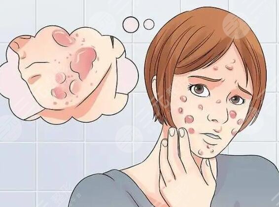 北京美萊醫(yī)療美容祛痘案例分享