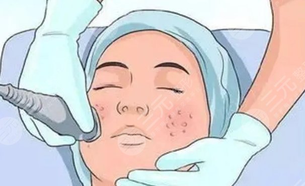 上海東方醫(yī)院激光祛斑案例