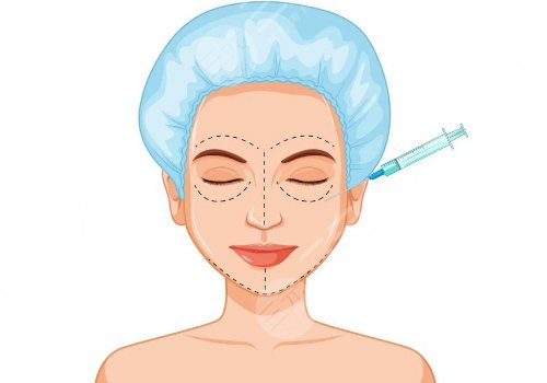 艾維嵐注射后多久消腫？