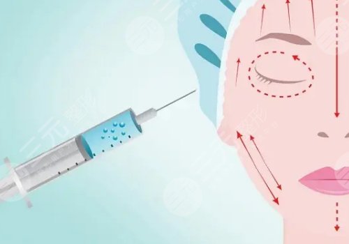 面部填充膠原蛋白多少錢？