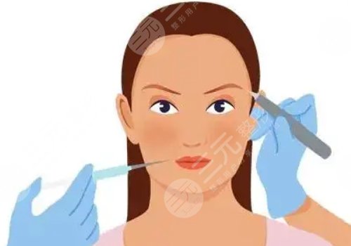 面部填充膠原蛋白多少錢？