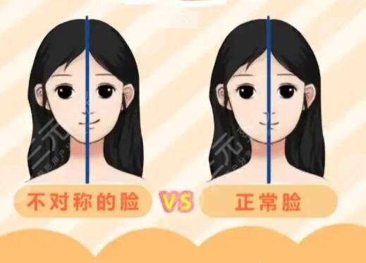 下頜骨一高一低臉歪矯正后需要怎樣護理?