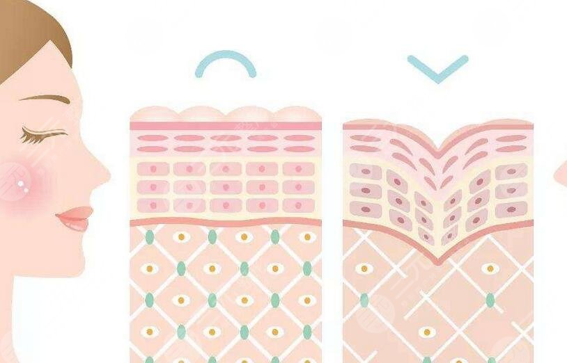 面部填充膠原蛋白多少錢？