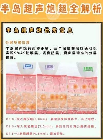 半島黃金超聲炮和超聲炮的區(qū)別有哪些？