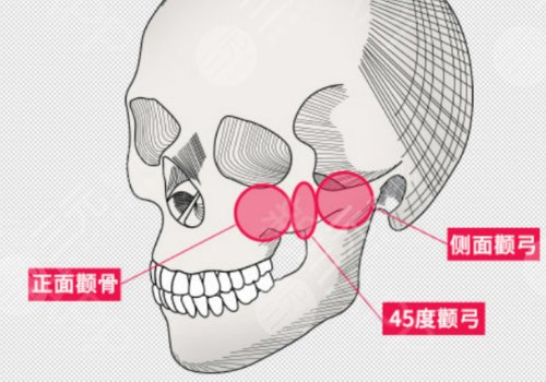削骨三年后的真實(shí)案例