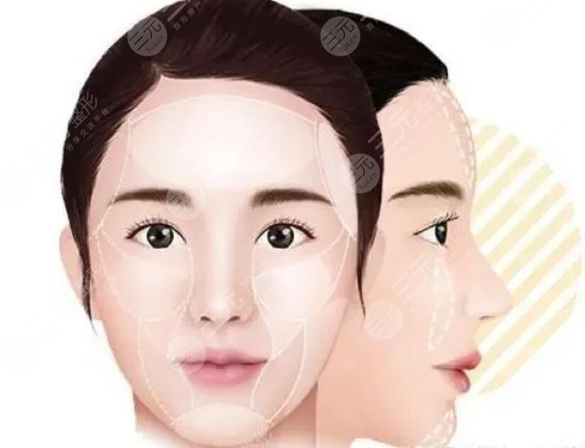 饅化臉是怎么形成的？