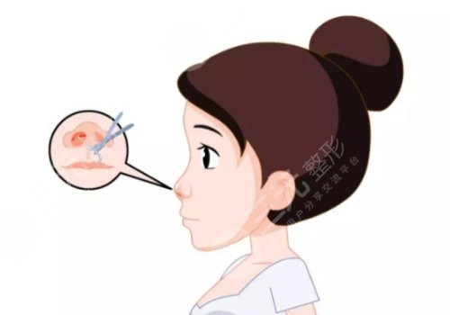 歐陽春鼻子做得怎么樣