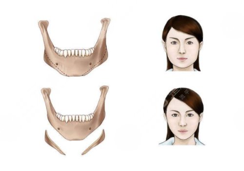 北大口腔醫(yī)院頜面外科專(zhuān)家排行