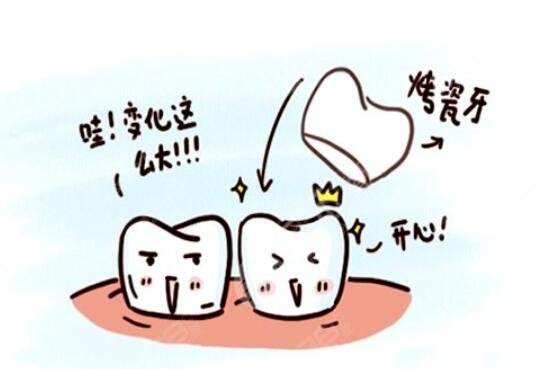 全瓷
