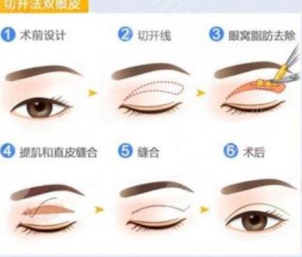 北京美萊醫(yī)療美容醫(yī)院擅長項目