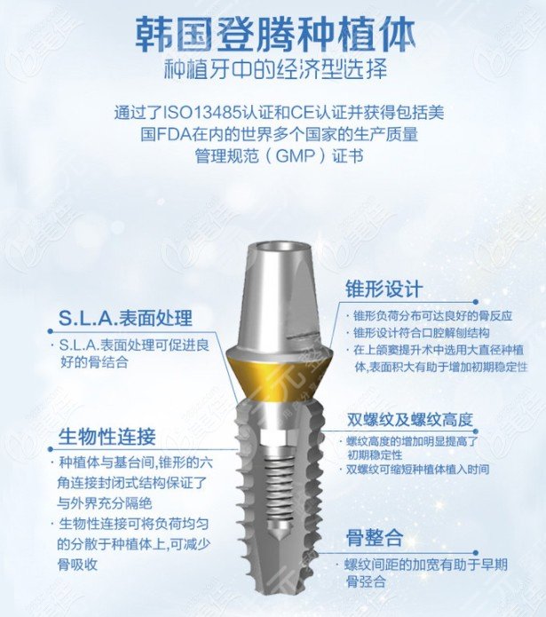 韓國登騰種植牙