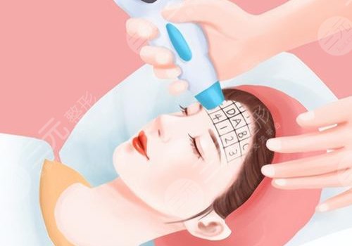 去色素斑用什么藥膏好？