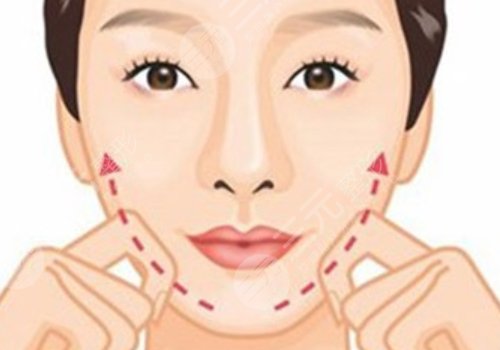 于艷菊醫(yī)生取生長因子嗎