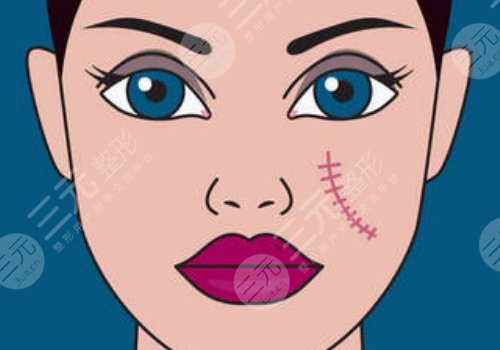 于艷菊緩解疤痕怎么樣