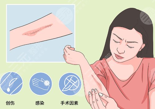 于艷菊緩解疤痕怎么樣