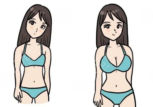 同濟(jì)葉子榮隆胸怎么樣