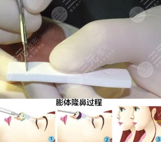 深圳陽光醫(yī)療美容醫(yī)院擅長項目