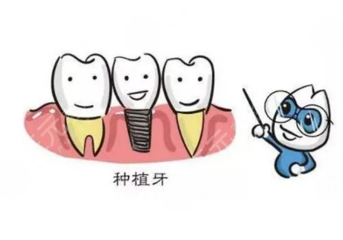 成都新橋口腔醫(yī)院種牙怎么樣