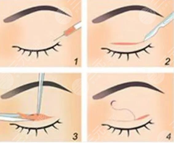 北京美萊醫(yī)療美容醫(yī)院擅長項(xiàng)目