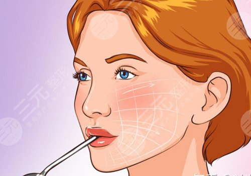 7d聚拉提大概全臉下來(lái)多少錢