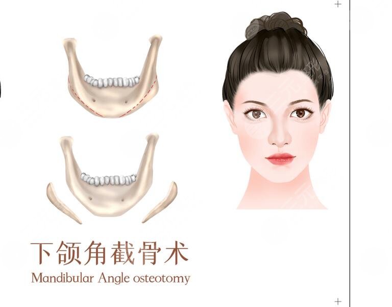 上海第九人民醫(yī)院整復(fù)外科專家醫(yī)生名單