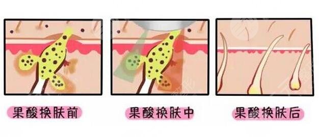  <p style="text-align: center;"> 	<span style="color:#ff0000;"><strong>【想變美嗎？預(yù)約醫(yī)生 獲取優(yōu)惠 點(diǎn)擊 &rarr;咨詢&larr;】</strong></span></p>