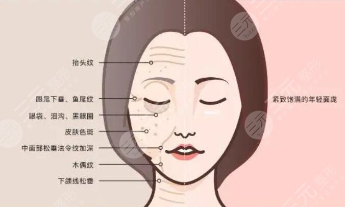 抗衰