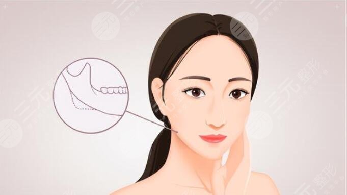 華山醫(yī)院做下頜角手術(shù)好嗎?