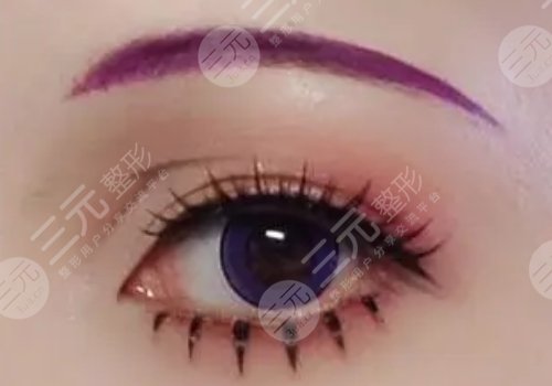 南京胡亮擅長(zhǎng)做雙眼皮嗎