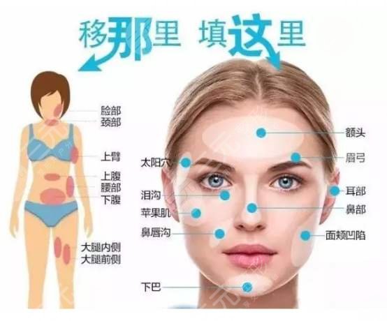 王紹國(guó)醫(yī)生做填充嗎
