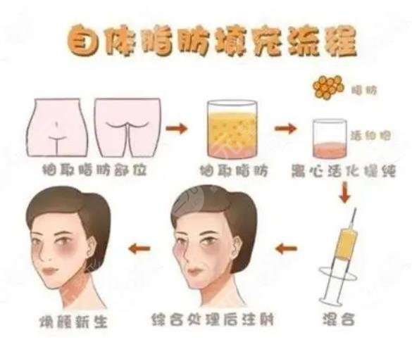 上海同濟(jì)醫(yī)院整形外科特色項(xiàng)目