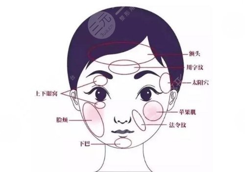 臉部脂肪填充多少錢