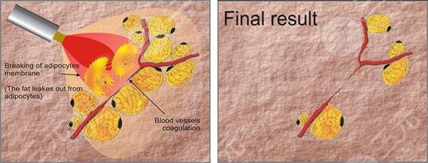 上海六院美容科怎么樣