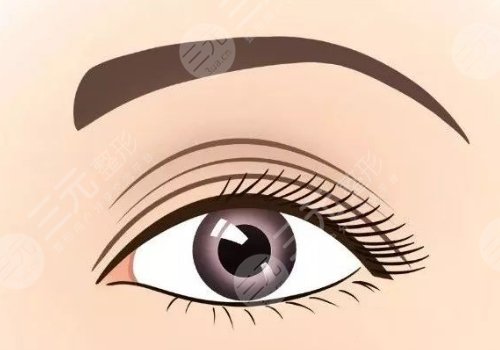 廈門(mén)海峽做雙眼皮那個(gè)醫(yī)生好