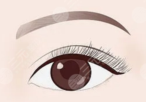 敖健飛做雙眼皮修復(fù)怎么樣