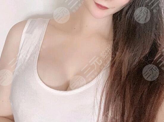 水滴型假體隆胸前后對比效果圖片和手術(shù)過程分享，小白隆胸避坑！