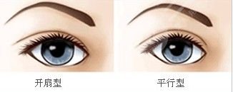 丁金萍醫(yī)生做的雙眼皮怎么樣