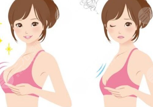 辛敏強(qiáng)隆胸收費(fèi)價(jià)目表