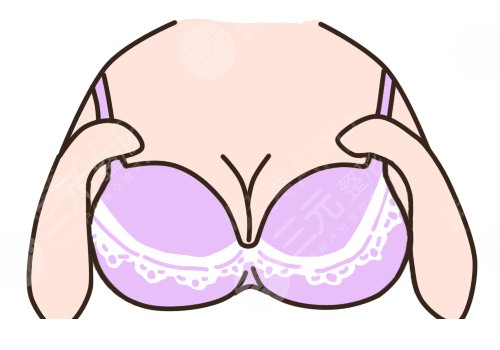 穆大力醫(yī)生做胸的真實(shí)術(shù)后感