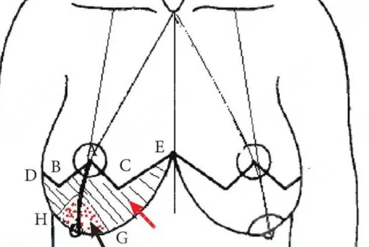 巨乳縮小動(dòng)漫03.jpg