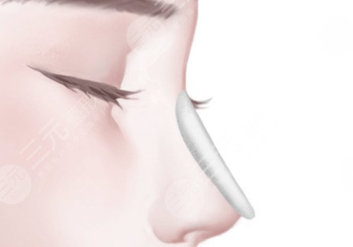 上海第九人民醫(yī)院做鼻子哪個醫(yī)生好