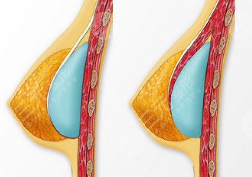 范希玲一天排幾個(gè)手術(shù)