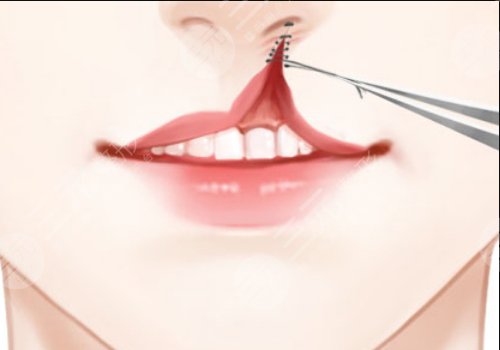 上海九院整形外科哪個(gè)醫(yī)生好